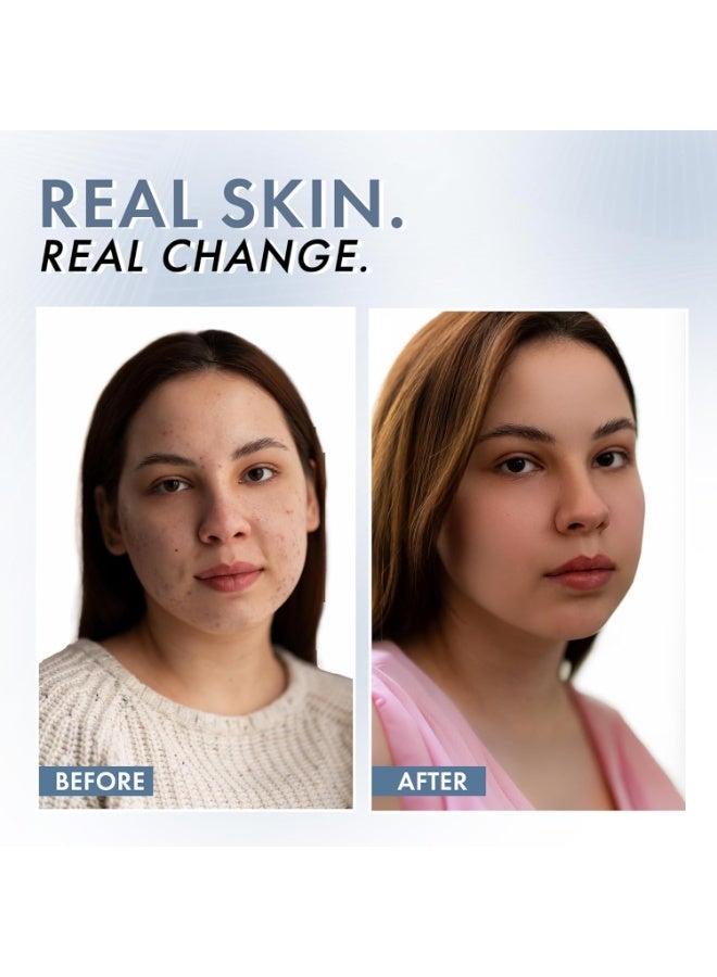 ThriveCo 10% Vitamin C Face Serum | Brightens Skin & Helps Reduce Dark Spots | With 33 kDa + 5 kDa Hyaluronic Acid | Boosts Hydration & Glow | For Men & Women | 30 ml - Image 2